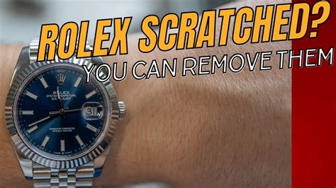 scratches on rolex datejust face|removing scratches from rolex watch.